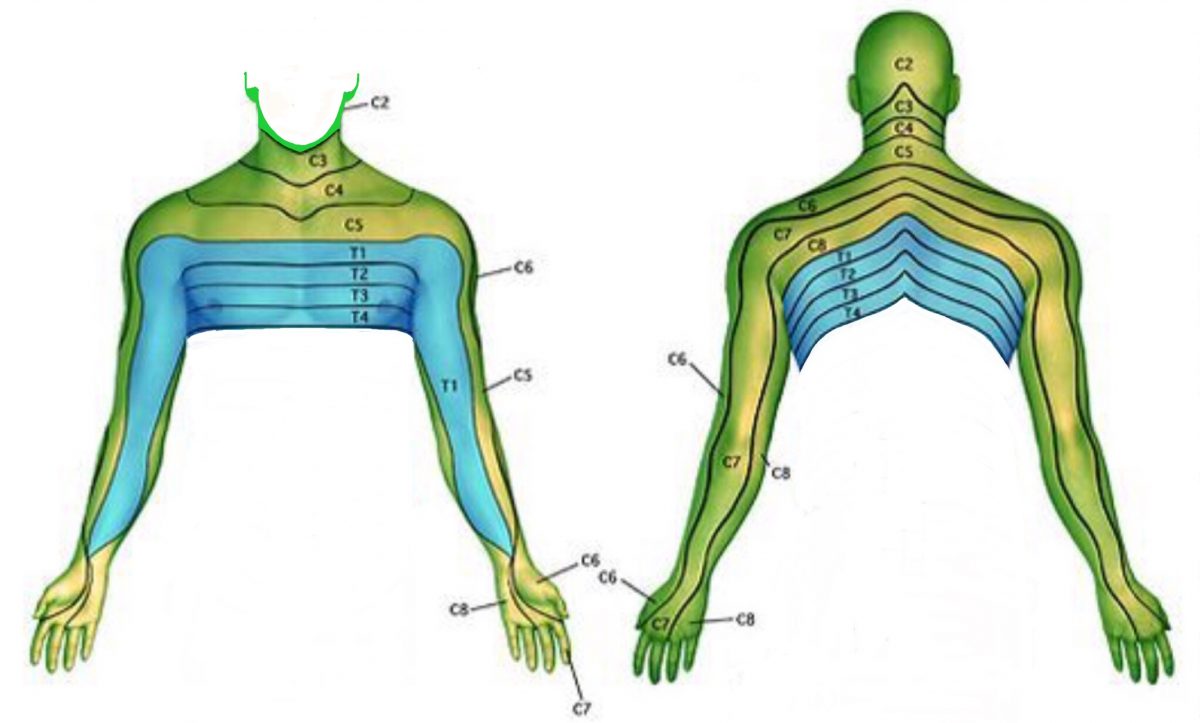 Neck And Arm Pain Spines Dorset