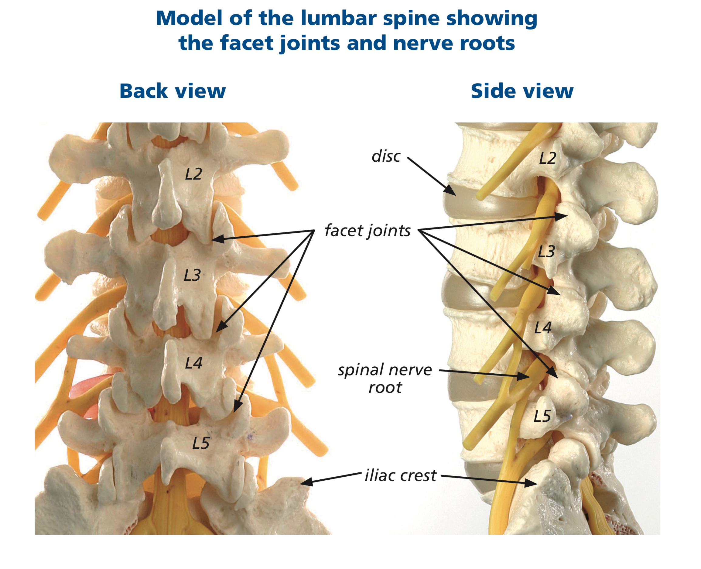 Facet Joint Disease Spines Dorset