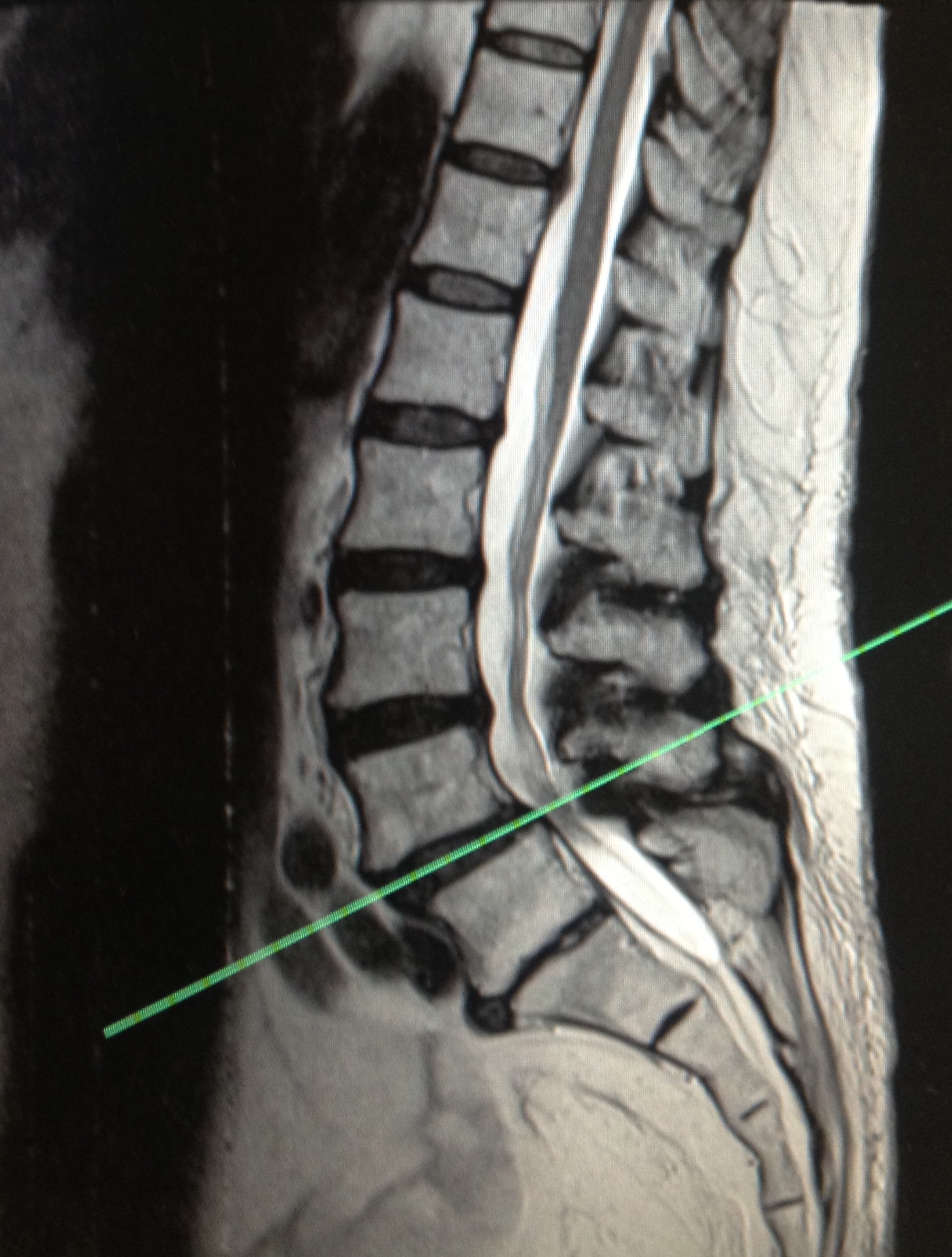 Back Pain Spines Dorset