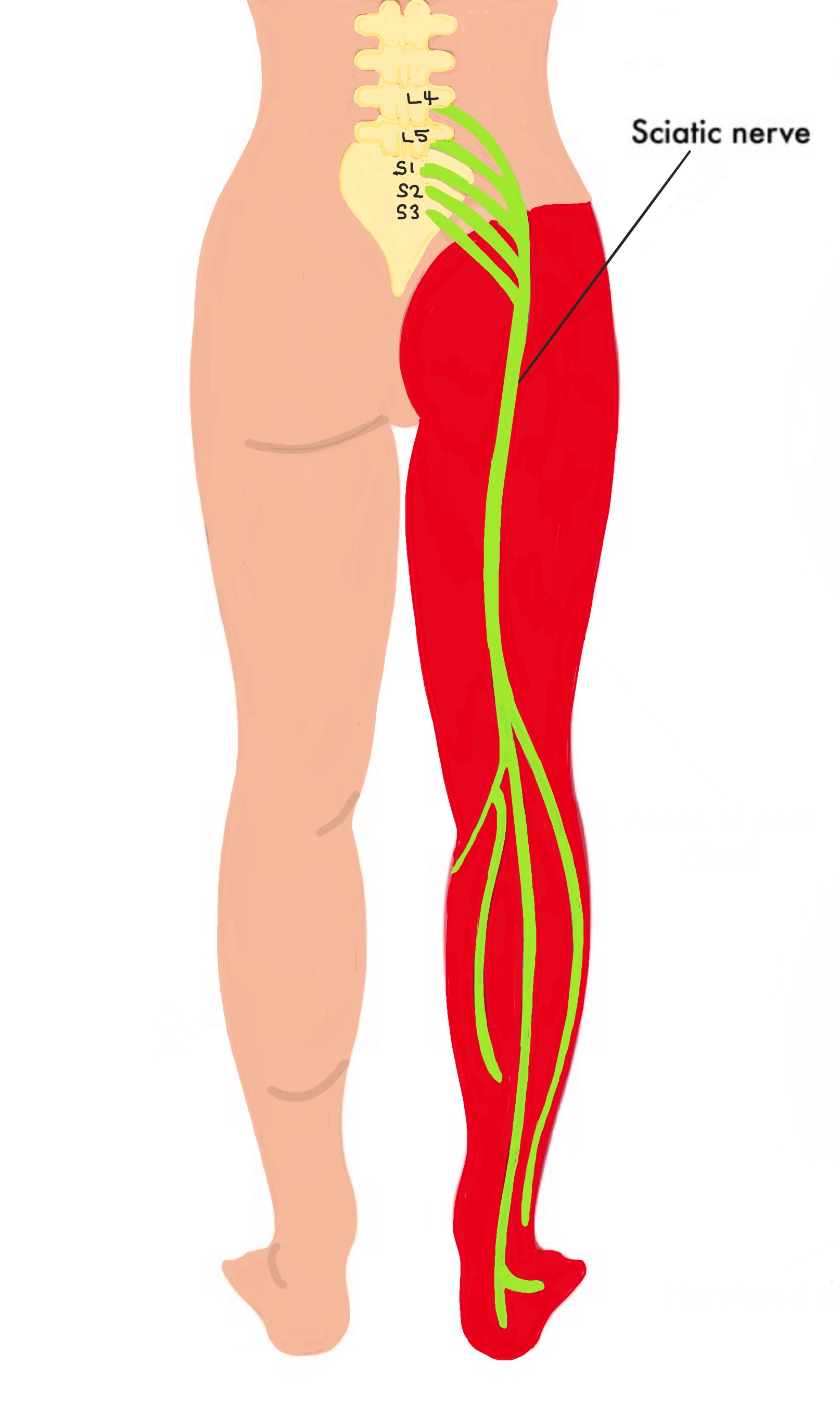 Седалищный в пояснице. Sciatic nerve анатомия. Седалищный нерв (sciatic nerve)?. Седалищный нерв в колене.