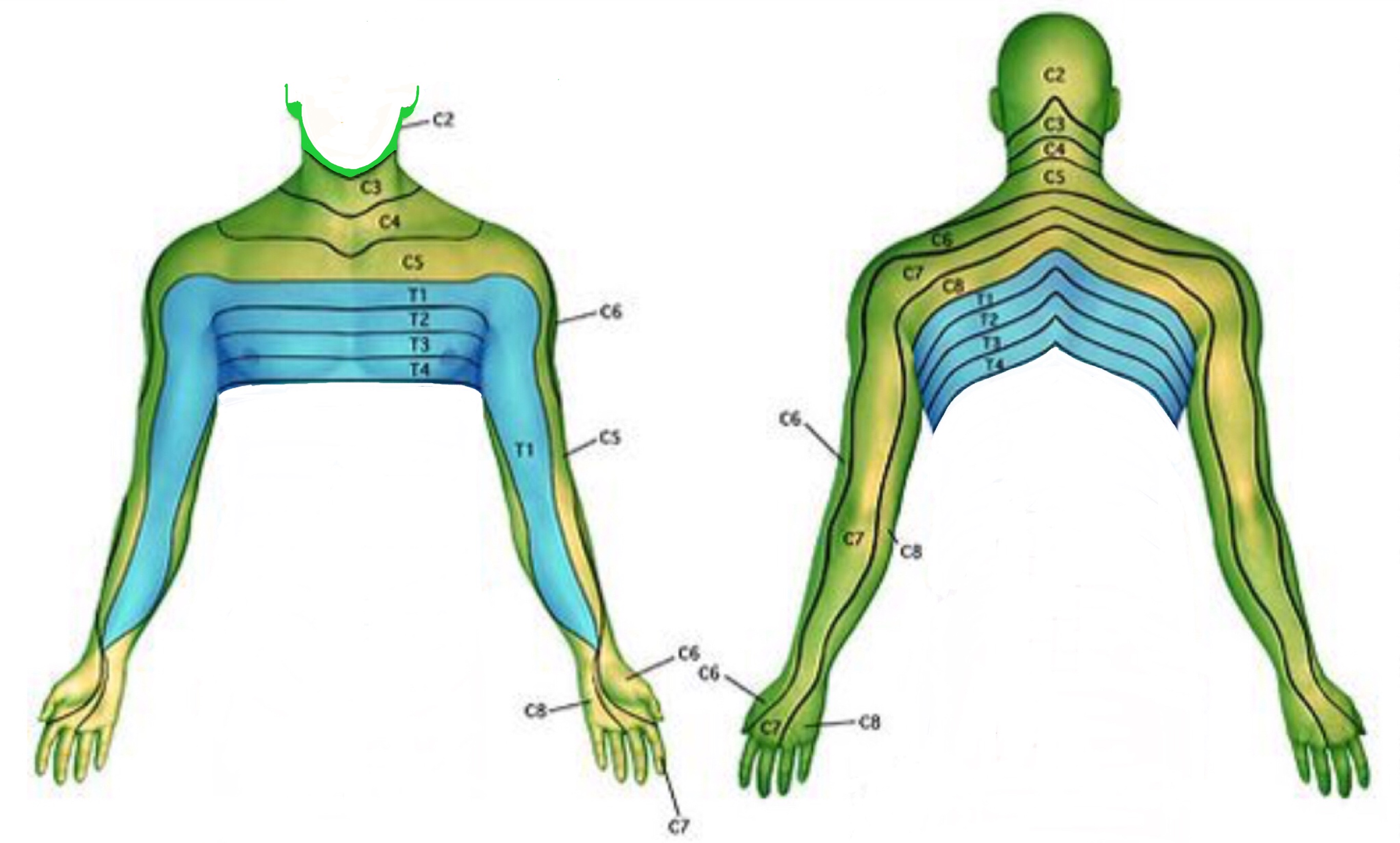 The Dermatome chart shows how the the different nerves map out the differen...